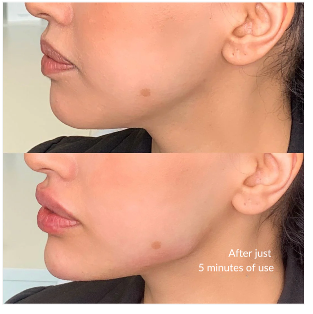 Lymphatic Contour Face Brush